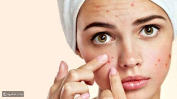 علاج الحبوب في الوجه للبشرة الدهنية