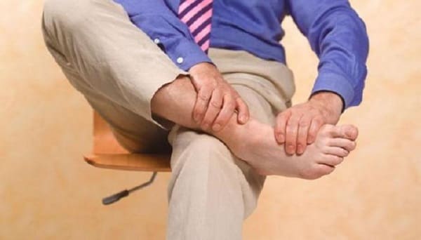 الدوالي عند الرجال في الساقين.. أعراضها وأسباب ظهورها