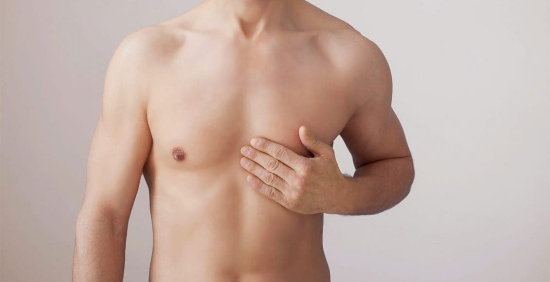 علاج التثدي عند الرجال بدون جراحة
