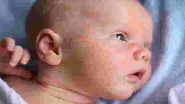 حساسية الجلد عند الأطفال الرضع