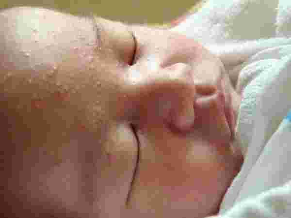 حساسية الجلد عند الأطفال حديثي الولادة وأنواعها وكيفية ...