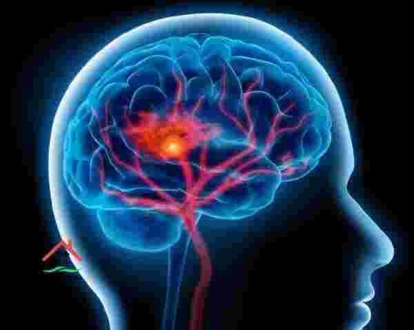 علاج كهرباء المخ الزائدة من خلال الأطعمة والمشروبات