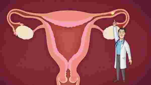 أعراض الحمل خارج الرحم في الشهر الأول