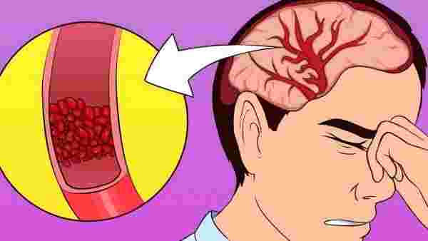 أهم أسباب تؤدي إلى ألم الرأس