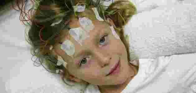 اعراض كهرباء المخ عند الاطفال