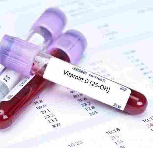تحليل فيتامين د يحتاج صيام