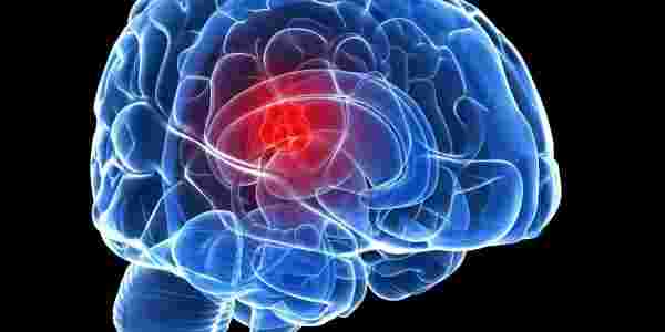 مضاعفات عملية استئصال ورم الدماغ