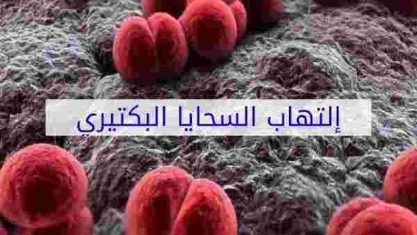 مضاعفات مرض التهاب السحايا البكتيري