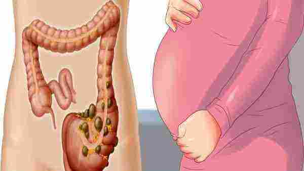 الغازات عند الحامل في الأشهر الأولى وكيفية علاجها بعدة طرق مميزة زيادة