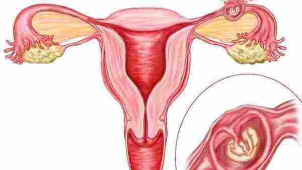 أسباب حدوث الحمل خارج الرحم
