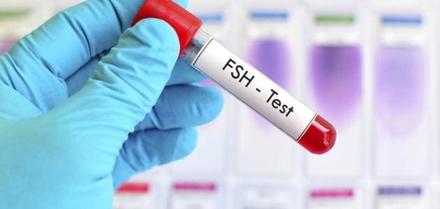 علاج ارتفاع هرمون FSH عند الرجال