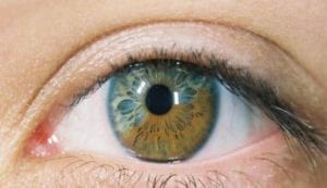 ما سبب رؤية خيوط امام العين وما هي عوامات العين - زيادة