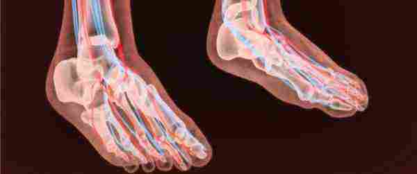 أعراض التهاب الأعصاب في القدم