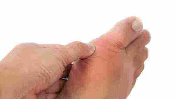 أسباب التهاب اصبع القدم الكبير