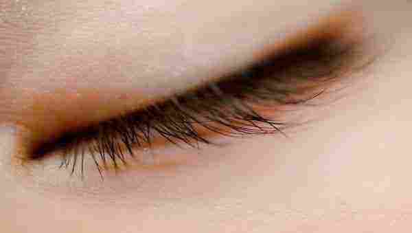 علاج ارتخاء الجفن العلوي للعين