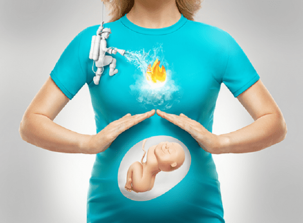 علاج سريع للحموضة عند الحامل