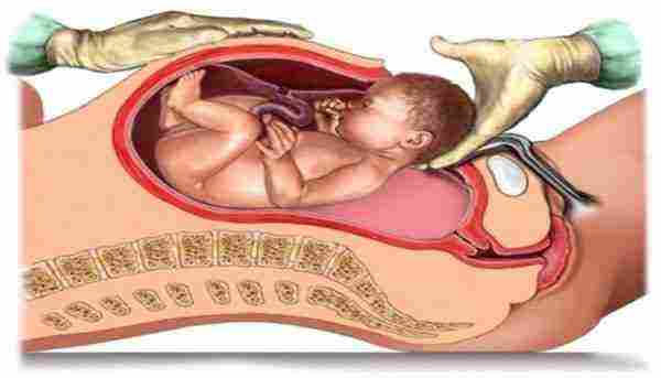 تفسير حلم الولادة المبكرة للحامل للنابلسي وللرجل والعزباء والمتزوجة زيادة