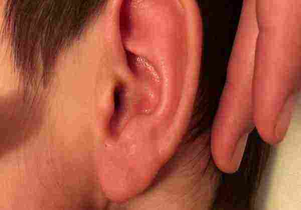 أسباب الإصابة بالتهاب الأذن الخارجية