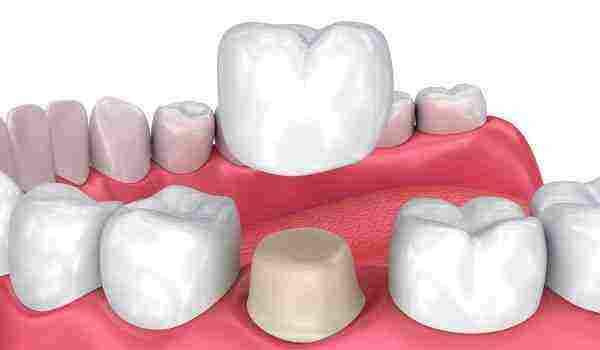 أهمية العصب الخاص بالأسنان