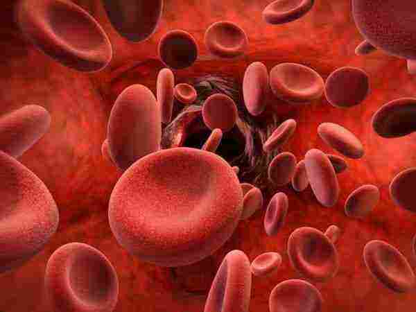 نقص الصفائح الدموية وسرطان الدم