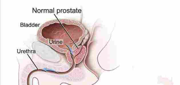 أعراض إلتهاب البول عند الرجال واحتقان البروستاتا