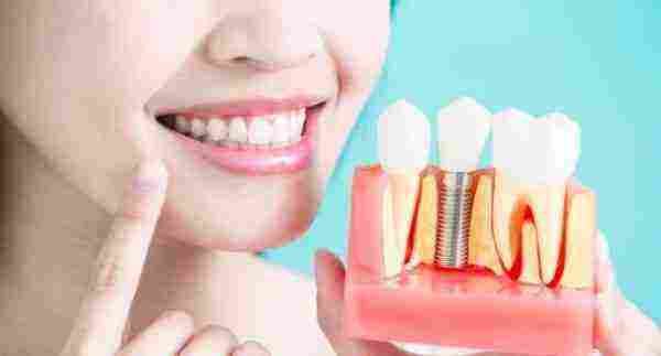 هل زراعة الاسنان تسبب السرطان