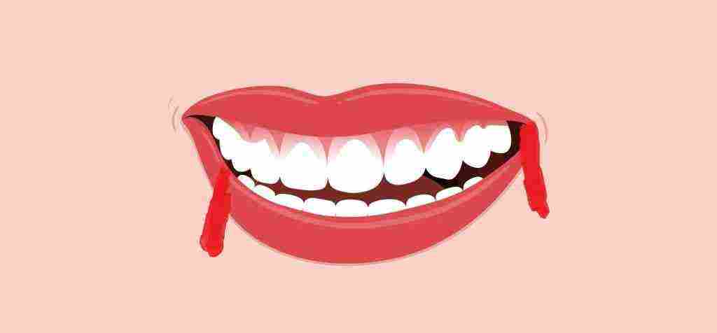 أسباب خروج الدم من الفم مع البلغم