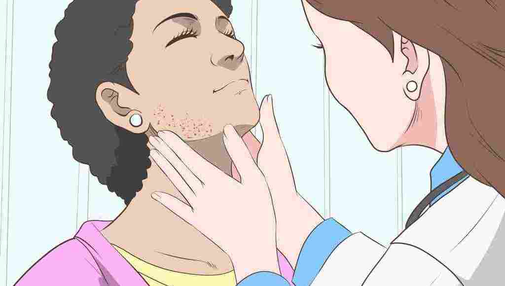 اعراض فيروس سي على الوجه وعلاجها