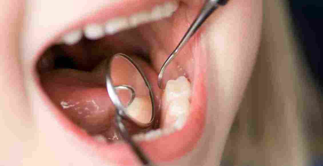 علاج تسوس الأسنان بالقرآن