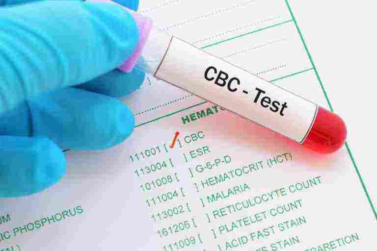 هل تحليل cbc يكشف السرطان