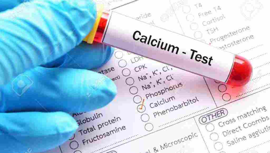 نسبة الكالسيوم الطبيعية في الدم