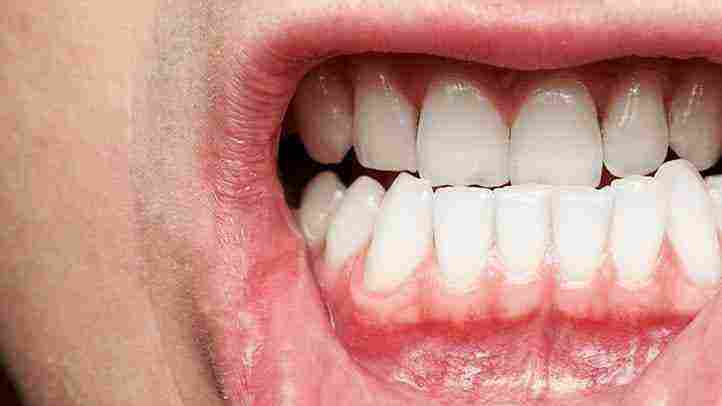 أسباب آلام اللثة تحت الاسنان