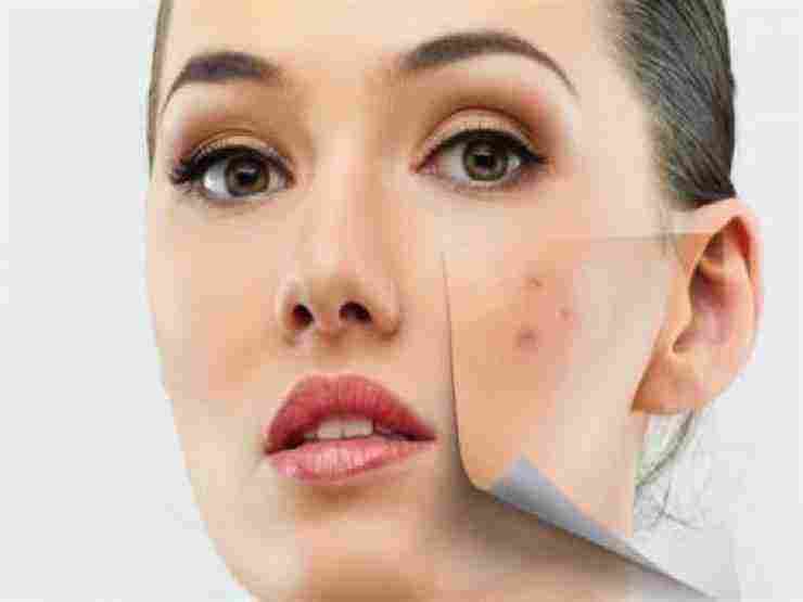 علاج حساسية الوجه بالمواد الطبيعية