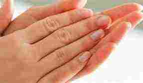 علاج اكزيما اليدين بالاعشاب