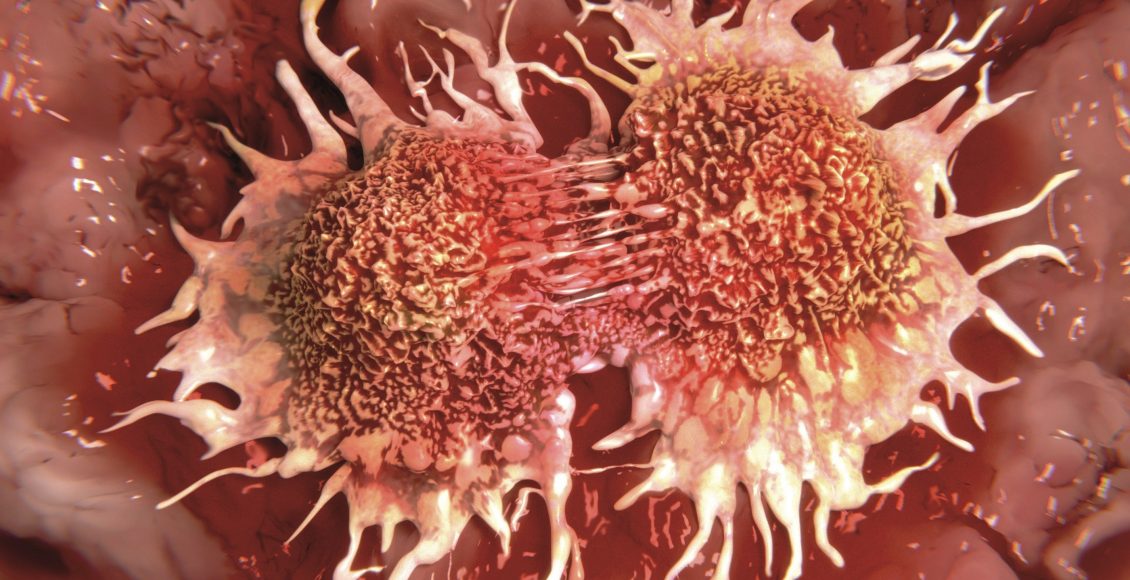 شكل الورم السرطاني بالصور