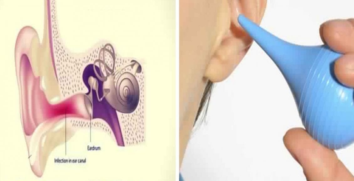 علاج الزكام وانسداد الأذن