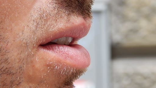 الامراض التي تسبب مرارة الفم