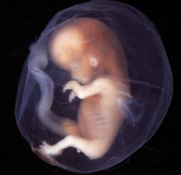 مراحل نمو الجنين داخل الرحم بالصور 3