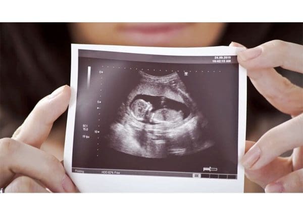 شكل الجنين في الشهر الثالث بالسونار الحمل والولادة ماميز بيبي