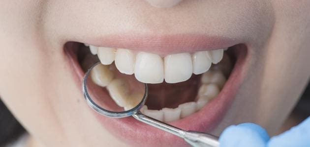 اسباب وعلاج تسوس الأسنان