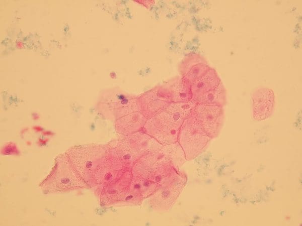 الخلايا الظهارية في البول