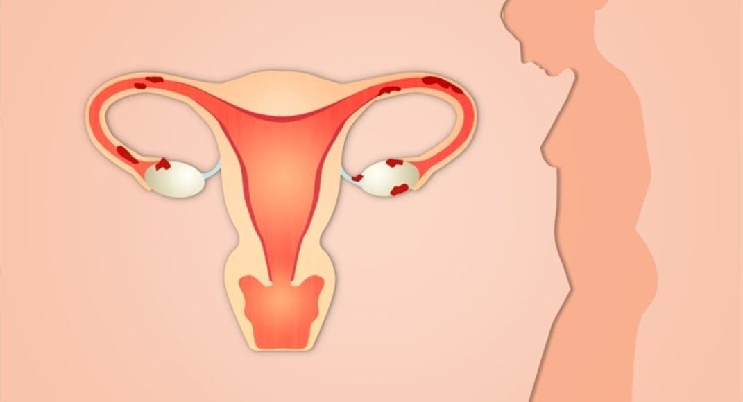 معرفة الحمل من عنق الرحم