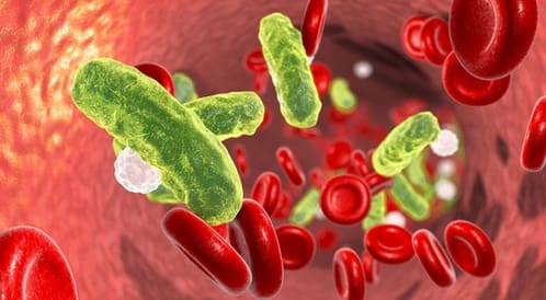 هل بكتيريا الدم تسبب الوفاة