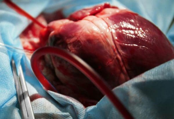 تخصص جراحة القلب