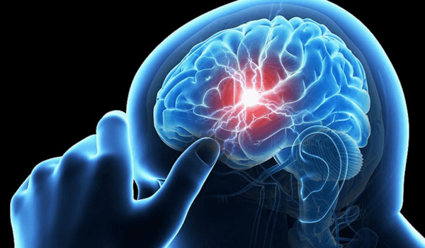 علاج الأعصاب في الرأس