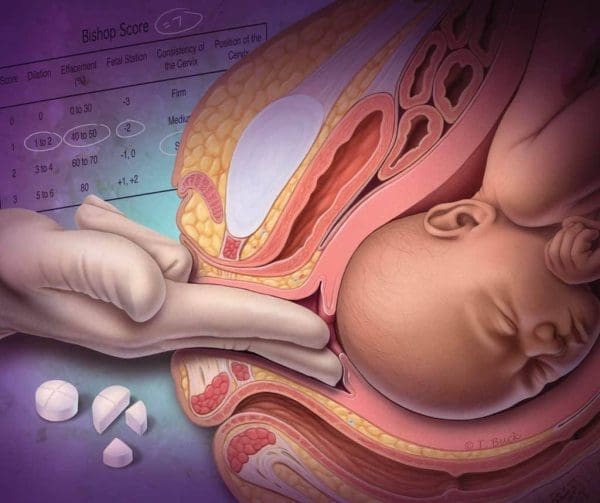 توسيع الرحم باليد للولادة وعنق الرحم وأفضل طرق طبيعية لتوسيع الرحم استعدادا للولادة زيادة