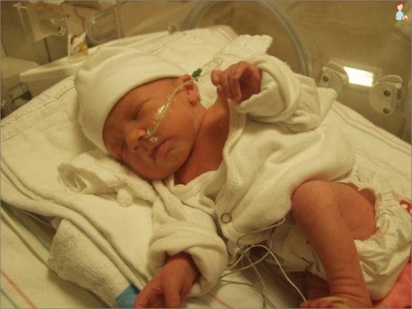 درجات اليرقان عند حديثي الولادة واستمرار الصفار عند الرضع لأكثر من شهر زيادة