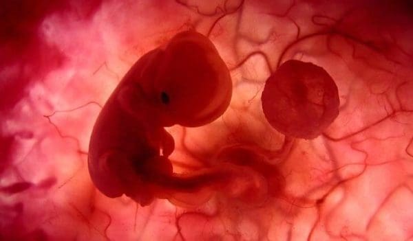 أعراض بقايا المشيمة في الرحم بعد الإجهاض