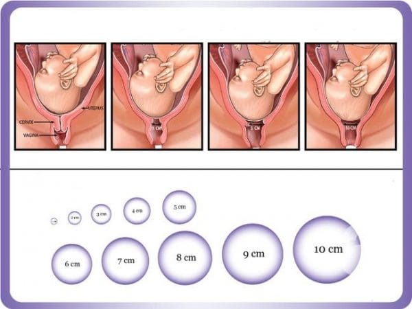 إذا فتح الرحم 4 سم متى تكون الولادة