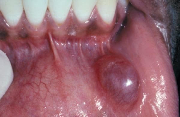 أمراض الفم واللثة بالصور